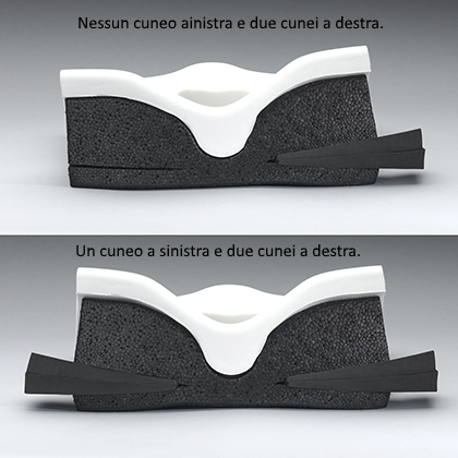 If needed, posture can be adjusted through the use of Ride CAM wedges. They can be positioned assymetrically (shown at top), with up to two wedges being inserted on each side, then trimmed. CAM wedges can also be positioned symmetrically (bottom), with up to two wedges being inserted on each side. (Rear view)