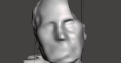 Scan cranico CAD-CAM