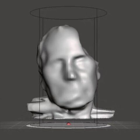 Scan cranico CAD-CAM